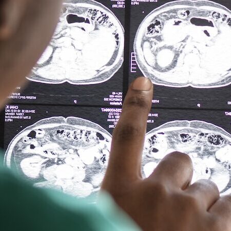 Życiorysy lekarzy specjalistów Lekarz neurochirurg